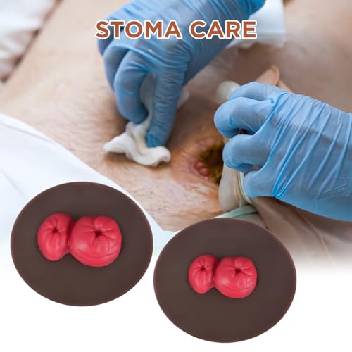 Image of Sticky Loop Ileostomy Simulators, Double-Barrel Stoma Training Model Set, Multi-Skin Tone Ostomy Care Practice Models for Medical Training and Patient Education - Dark