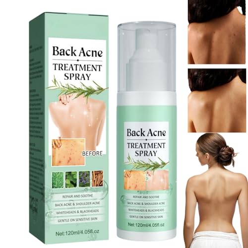 Acne Treatment Spray for Back & Body - 120ml