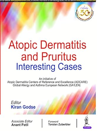 Atopic Dermatitis and Pruritus: Interesting Cases