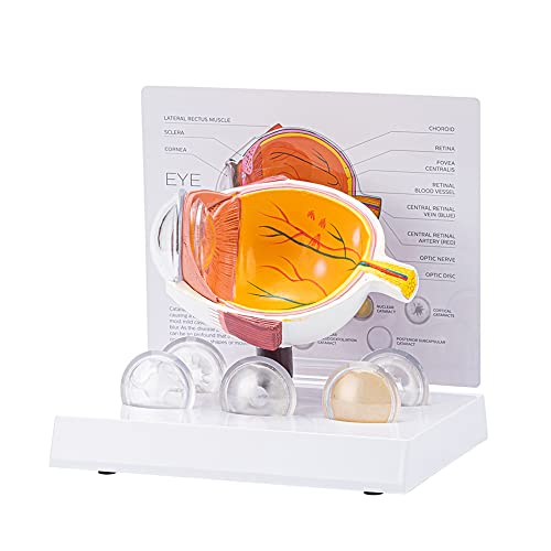 Modèle de globe oculaire de la cornée pour expliquer la cataracte