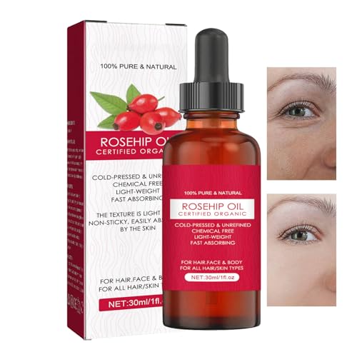 De Rosa Mosqueta Orgánico - 30ml Extracto De Semilla Prensado En Frío | Cuidado Cutáneo Hidratante | Fórmula Amigable Con La Piel Ayuda A Reducir Estrías, Suaviza Cabello, Fortalece Uñas, Para