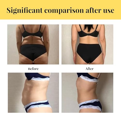 Slim Patch, Weight Loss Patch, Belly Fat Burning Patch, Enhanced Abdominal Fat Burning, Slimming Waist, Belly Fat Waist - Image 7