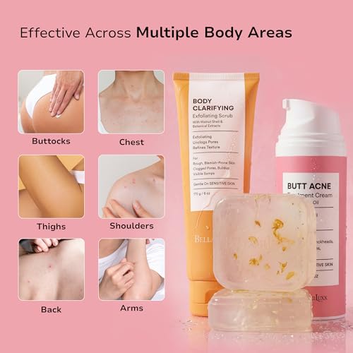 Image of BellamiLuxx Butt Acne Treatment Set: Acne Soap Bar + Butt Treatment Lotion for Breakouts on Buttocks, Thighs, Back, Chest & Ingrown-Prone & Folliculitis-Prone Skin - Helps Reduce Body Breakouts