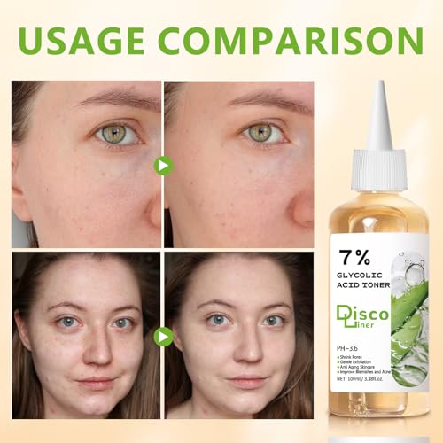 Discoliner 7% Glycolic Acid Exfoliating Toner, Hydrating Facial Toner, Smooth Glowing Skin, Even Skin Tone, Improve Skin Texture, Gentle Formula for Daily Use