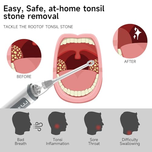 Image of Oral Cleaning Kit - Vacuum Tonsil Stone Removal Kit With 3 Suction Modes Oral Irrigator, Fight Bad Breath, Built-in LED Light & Magnifying Mirror for Effective Tonsil Stone Removal & Bad Breath Relief