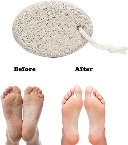 Image of Red Square Pumice Stone 2 Pcs, Natural Lave Pumice Stone for Feet /Hand, Small Callus Remover /Foot Scrubber Stone for Men /Women - Multicolor