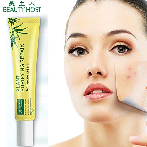 World Beauty's New Acne Cleaning Cream Anti Acne Treatment Whitening