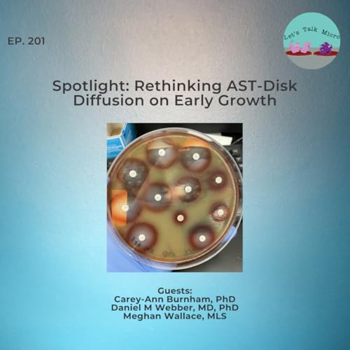 201: Spotlight: Rethinking AST-Disk Diffusion on Early Growth Podcast Por arte de portada