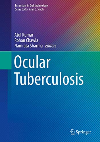 Ocular Tuberculosis (Essentials in Ophthalmology)