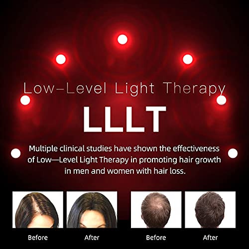 KERNELMED-Laser-Hair-Growth-Helmet-FDA-Cleared-Hair-Loss-Regrowth-Cap-Treatment-for-Men-and-Women-Uses-Laser-Comb-Hair-Loss-Products-Red-Light-Therapy