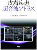【裁断済み】皮膚疾患 超音波アトラス 裁断済み】皮膚疾患 超音波アトラス - メルカリ