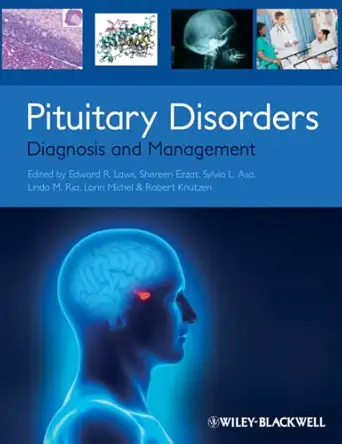 Pituitary Disorders: Diagnosis and Management-Wow! eBook