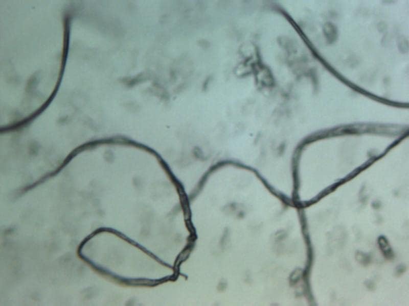 PCI Pinworm Test Kit: Accurate Detection for Anal Itching Caused by pinworms, Ideal for Anyone who has had Negative Results, Targets Peri-Anal Region, Includes 1 Pinworm Sticky Paddle Test kit