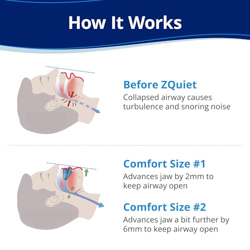 zquiet anti-snoring mouthpiece starter pack with 2 sizes living hinge amp open front design for comfort amp easy breathing blue