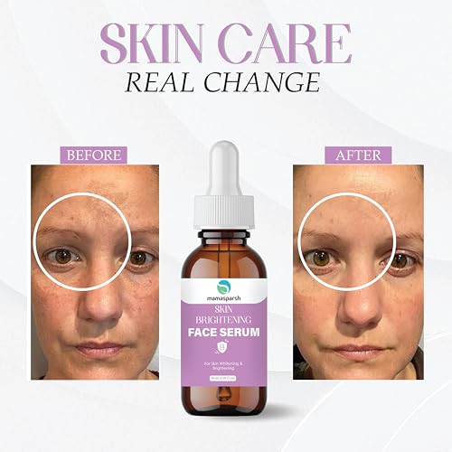 Image of Skin Brightening Face Serum with Vitamin B, Lightweight Hydrating Formula for Radiant Glow, Even Tone & Smooth Texture, Fast Absorbing Daily Skincare for All Skin Types, 30 ml