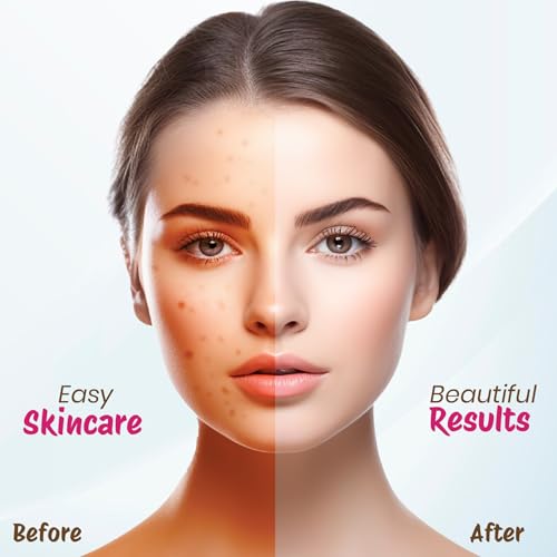 Image of Nisha Rose Multani Mitti for Face 100g | Fuller's Earth Powder | Natural Oil Control, Acne & Tan Removal | Skin Brightening Face Pack