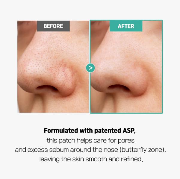 Miniatura 4 de Centella - Parches sin poros (1 caja, 8ea)  Parche hidrocoloide de poros nasales para eliminación de puntos negros  Parche facial calmante con
