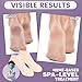 TEAWOO 5 Pairs Silicone Socks for Dry Cracked Feet, Women's Foot Socks for Moisturizing (Beige, Fits Up to Size 9)