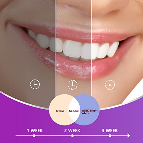 Purple Toothpaste For Teeth Whitening, Tooth Stain Removal Whitening Toothpaste, Teeth Whitening Booster, Purple Teeth Whitening Foam, Colour Correcting #TOP1