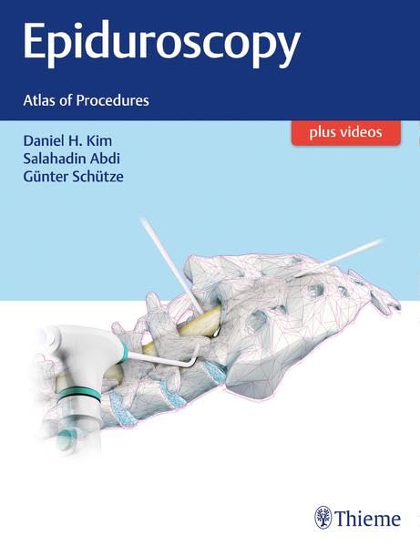 Buy Epiduroscopy: Atlas of Procedures — BookShops.in