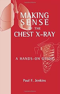 Making Sense of the Chest X-ray: A Hands-on Guide