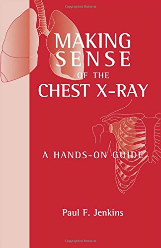 Buy (Old)Making Sense Of The Chest X-Ray : A Hands-On Guide(Org) — BookShops.in