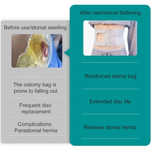 Faja abdominal de soporte para ostomía talla S miniatura 5