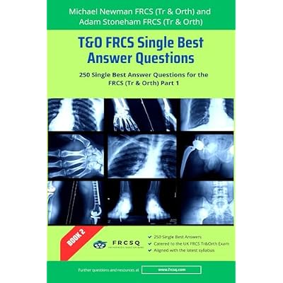 T&O FRCS Single Best Answer Questions