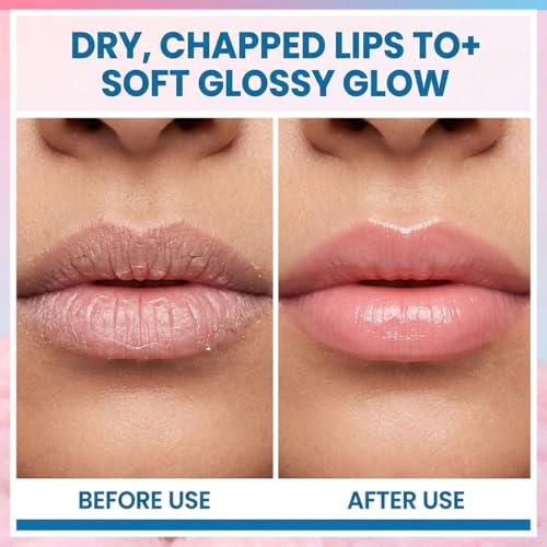 Image of HEY TEEN Bubble Gum Lip Balm Pack of 2 | for Pre-Teens & Teens | Ceramide NP, Carrot Seed Oil & Vitamin B12 | Botanical UV | Deep Moisture | Natural Glossy Finish | Dermatologist Recommended | 8 gm Each