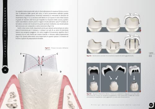 Preparazioni Dentali. Scienza & Arte - 6