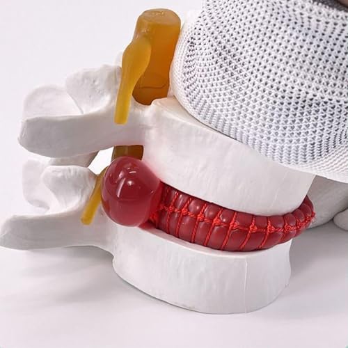 Modelo de columna lumbar con disco intervertebral aumentado 1,5X 7