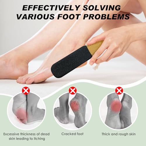 Foot File Pumice Stone Natural Pumice Stones for Feet, Premium Exfoliator & Foot File, Foot File Callus Remover Foot Cracked Heels, Dead Skin & Callus Remover for Soft and Delicate Feet, Black - Image 7