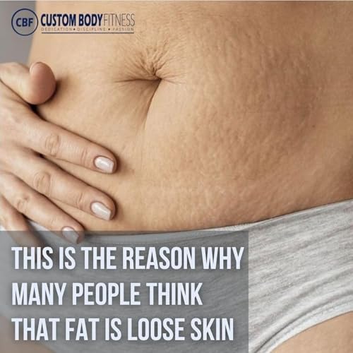 Episodio #180: &iquest;C&oacute;mo Puedo Tensar La Piel Fl&aacute;cida? La Verdad Que La Mayor&iacute;a De La Gente No Quiere Escuchar