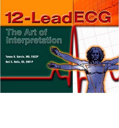 12 LEAD ECG THE ART OF INTERPRETATION PDF REDDIT visual data 3