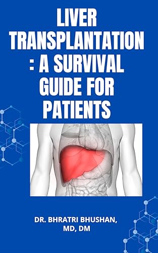 Liver transplantation: A survival guide for patients