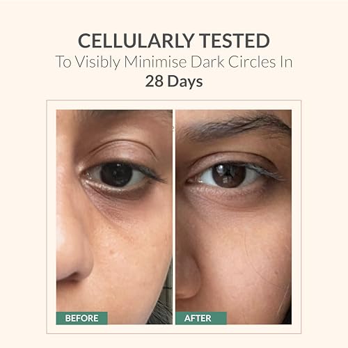Image of AreoVeda Under Eye Cream with Cooling Massage Roller | Under Eye Roll On with Quinoa for Dark Circles, Puffiness & Fine Lines | Pregnancy-Safe | 10 ml