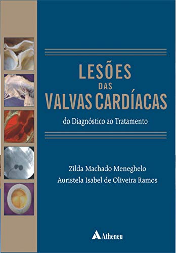 Lesões das Valvas Cardíacas: do Diagnóstico ao Tratamento