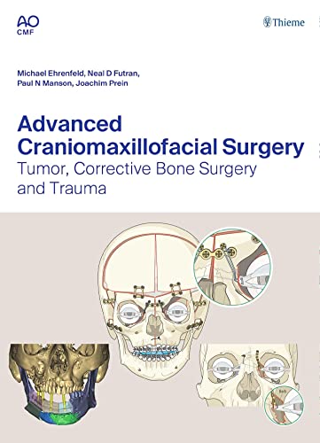 Advanced Craniomaxillofacial Surgery: Tumor, Corrective Bone Surgery, and Trauma