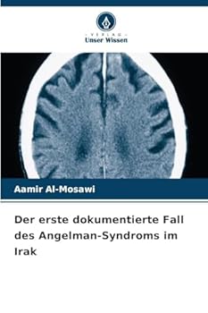 Der erste dokumentierte Fall des Angelman-Syndroms im Irak