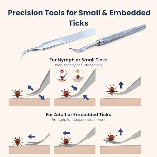 PetLuxe Care Complete Tick Removal Kit