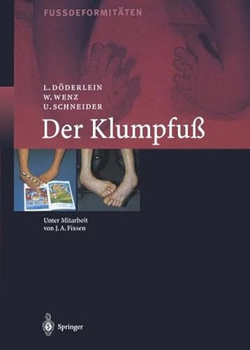 Der Klumpfuss: Erscheinungsformen und Behandlungsprinzipien jeden Alters. Differentialdiagnose und Differentialtherapie: Der Klumpfua. ... Differentialdiagnose Und Differentialtherapie