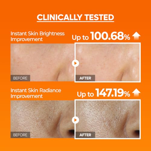 Image of Dr.Melaxin Peel Shot Mela-C.E Ferulic Serum Dead Skin Cells, Dullness & Uneven Texture, Vitamin C.E + Ferulic Acid, Retinar X, Korean Brightening Exfoliating Treatment, 2.70 fl. oz, 80ml