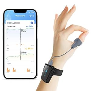 ViATOM Checkme O2 Pulsoximeter mit Bluetooth