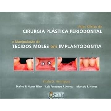 Capa do livro Atlas Clínico de Cirurgia Plástica Periodontal: E Manipulação de Tecidos Moles em Implantodontia