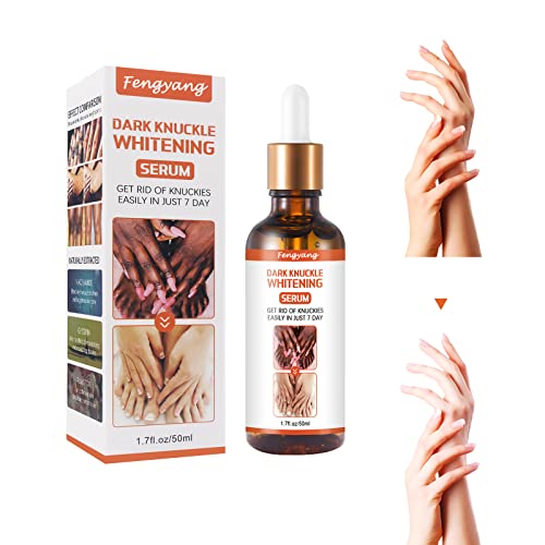 Fengyang® Siero Sbiancante Nocche Scure Per Mani, Siero Sbiancante per Articolazioni, Sbiancante per Le nocche, Olio Essenziale Schiarente Mani Nocche per la Rimozione Delle Nocche Scure