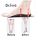 Dr. Foot's 3/4 Length Orthotics Insoles - Best Insoles for Corrects Over-Pronation, Fallen Arches, Fat Feet - Plantar Fasciitis, Heel Spurs and Other Foot Conditions -1 pair (M- W9-10.5 | M7.5-9)