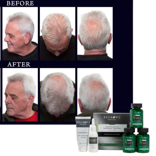 Regrowz Thickening Shampoo With Saw Palmetto 225Ml With Biotin Hair Growth Supplement For Men 60 Capsules #TOP7