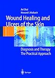 Wound Healing and Ulcers of the Skin: Diagnosis and Therapy - The Practical Approach