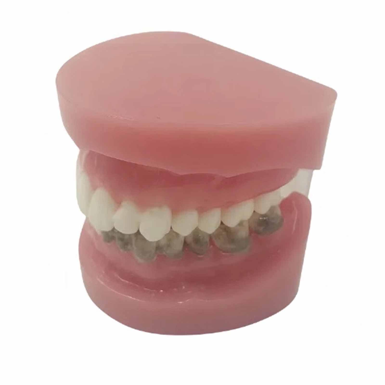 Model Zębów, Model Ekspozycyjny Z Nicią Dentystyczną, Do Nauki, Dla Dentystów, Studentów Stomatologii, Czysty Eksponat (Skóra 8 Cm),Flesh-8cm