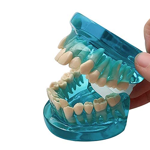 Modèle d'orthodontie Type de Dents pour Adultes, modèle de Dents dentaires Standard, modèle d'étude pour Soins des Dents. Modèle Standard pour l'enseignement